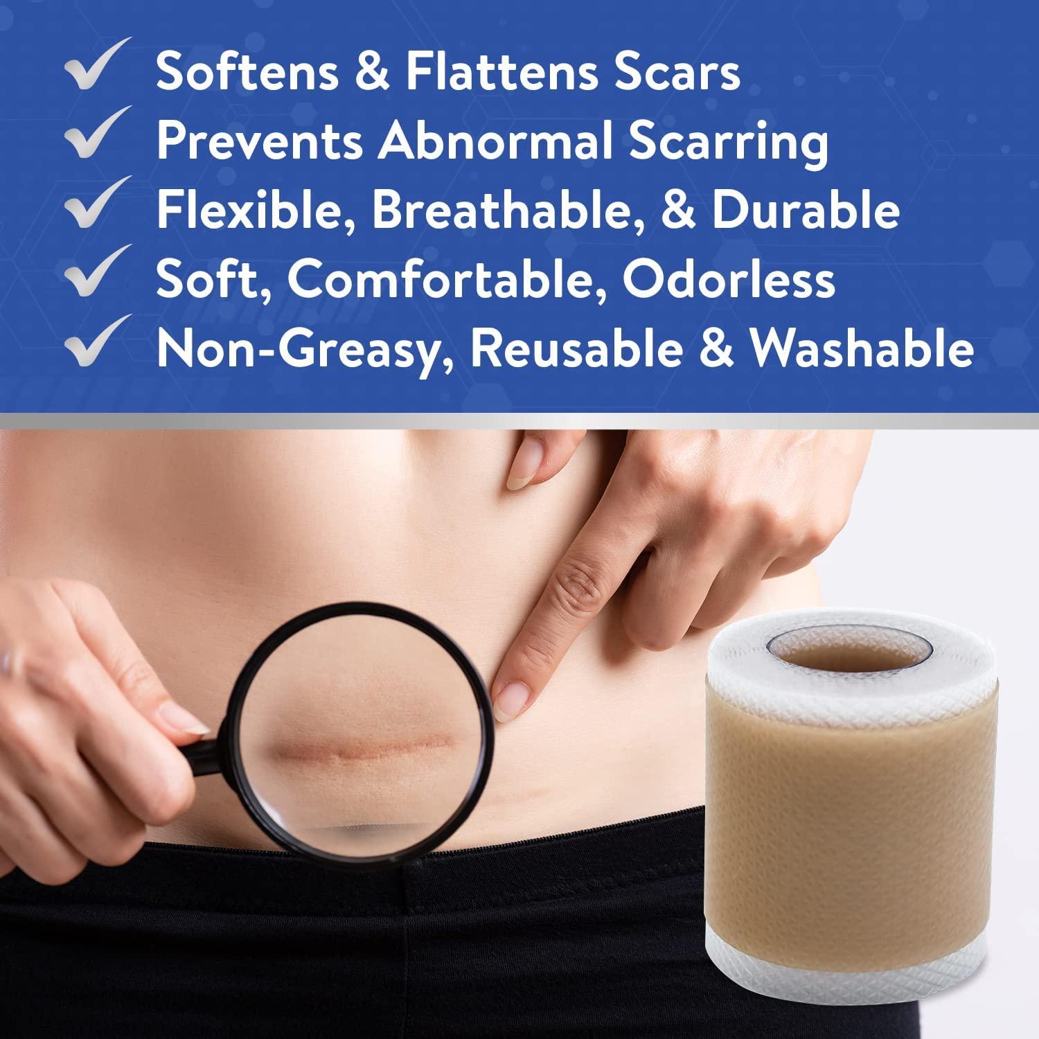 Retailio Retailio Silicone Scar Sheets Silicone Scar Tape 1.6x60" for Softening and Flattening Scars, C-Section, Keloid Surgery, Painless Removal, Reusable, Washable