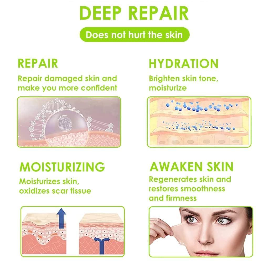 JOICE IMPEX JOICE IMPEX Scar Tape Silicon Sheet for Scar Removal Waterproof Medical Grade Soft Silicone Scar Tape Roll for Surgery Injury Tape