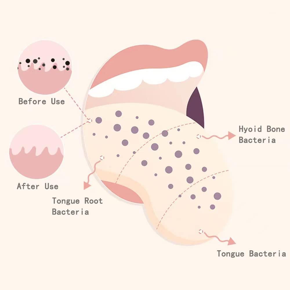 PIVHWIR PIVHWIR 4-Pack Tongue Scrapers, Tounge Scraper Cleaner Keep Fresher Breath, Tongue Cleaner Brush for Adults Kid Helps Fight Bad BreathRandom Color