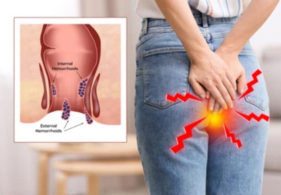 Generic Bavasir ki Dawa Ayurvedic Supplement for Piles- Promotes Digestive Health and Helps Relieve Pain - 10 Tablet (10 Day Course)