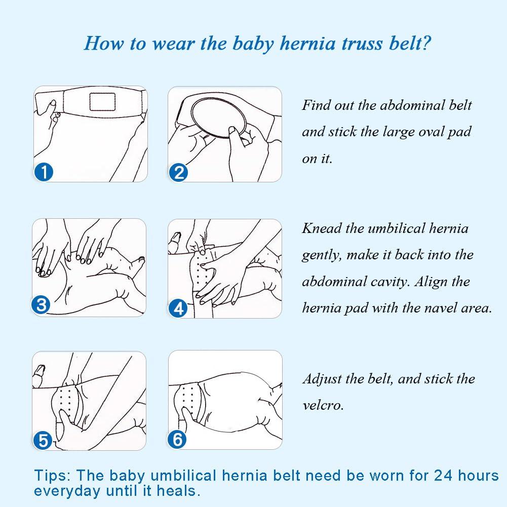 Paskyee Paskyee Umbilical Hernia Belt Baby Belly Button Band Infant Belly Wrap Abdominal Binder Hernia Truss Support Adjustable Navel Belly Band Newborn Umbilical Cord Blue