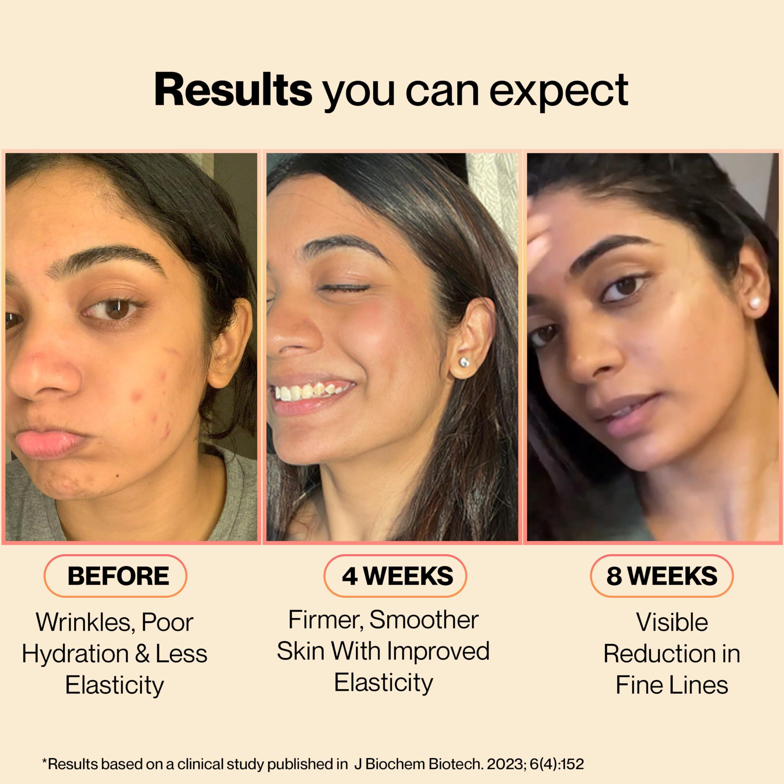 SETU Setu Skin: Youthful Marine Collagen Powder (15 Sachets) | Collagen Supplements for Women & Men | Hydrolyzed Type 1 & 3 Collagen for Healthy Skin, Hair & Nails | Peach Mango Flavor