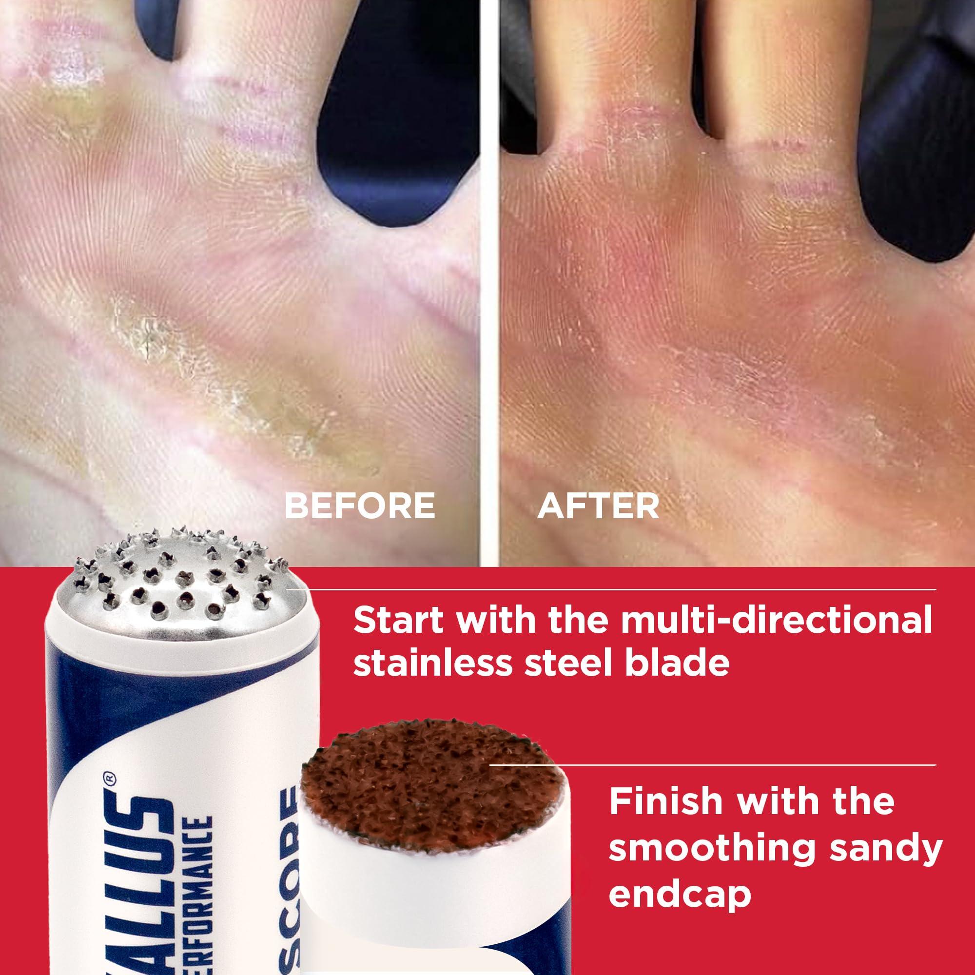 Callus Performance Callus Performance Callus Performance - The Ultimate Callus Remover for Crossfit Athletes and high Friction Hand use. l Remove unwanted Calluses I Prevents Ripping and Tearing of Hands I