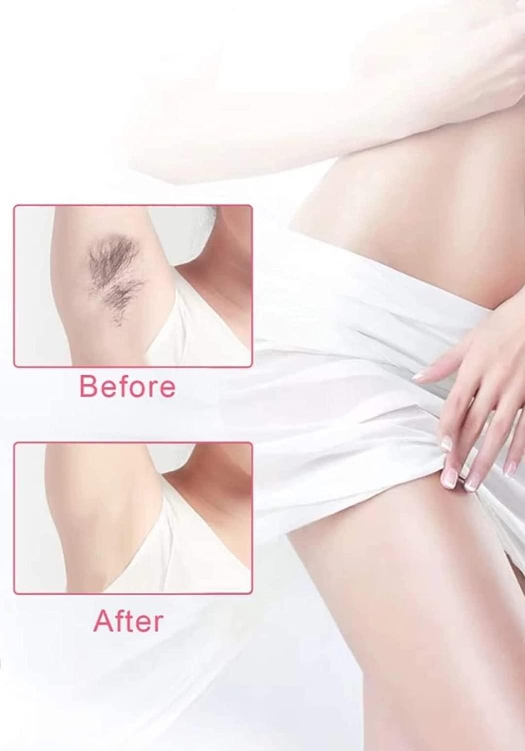 Kezona Kezona Women's Hair Removal Body Razor with Travel Case Smooth & Hassle-Free Shaving Razor for Body Hair