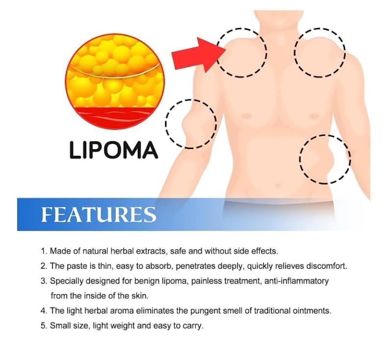 Lecherous Lipoma Removal Cream Mild Easy to Use Care Cream Wide Applaications | Mild & Comfortable | Herbal Remedies & Resins (Pack Of 3)