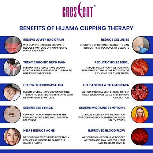 CRESCENT Crescent Hijama| Cupping Therapy Cups| Hijama Cupping Set| (Size 1, 6 Cups only)