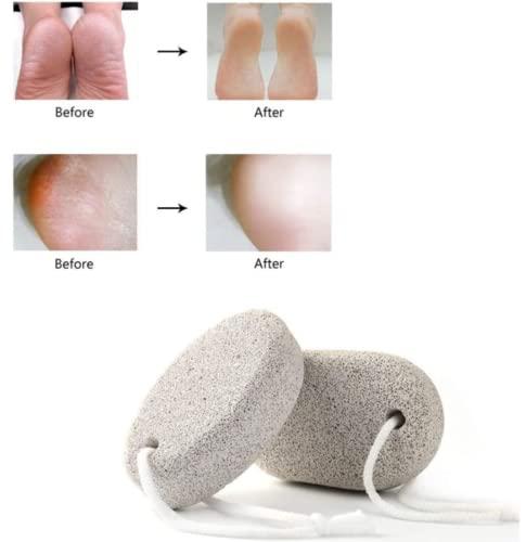 FEELHIGH Feelhigh Pumice Stone for Feet Remove Dead Skin Foot Scrubber (stone1)
