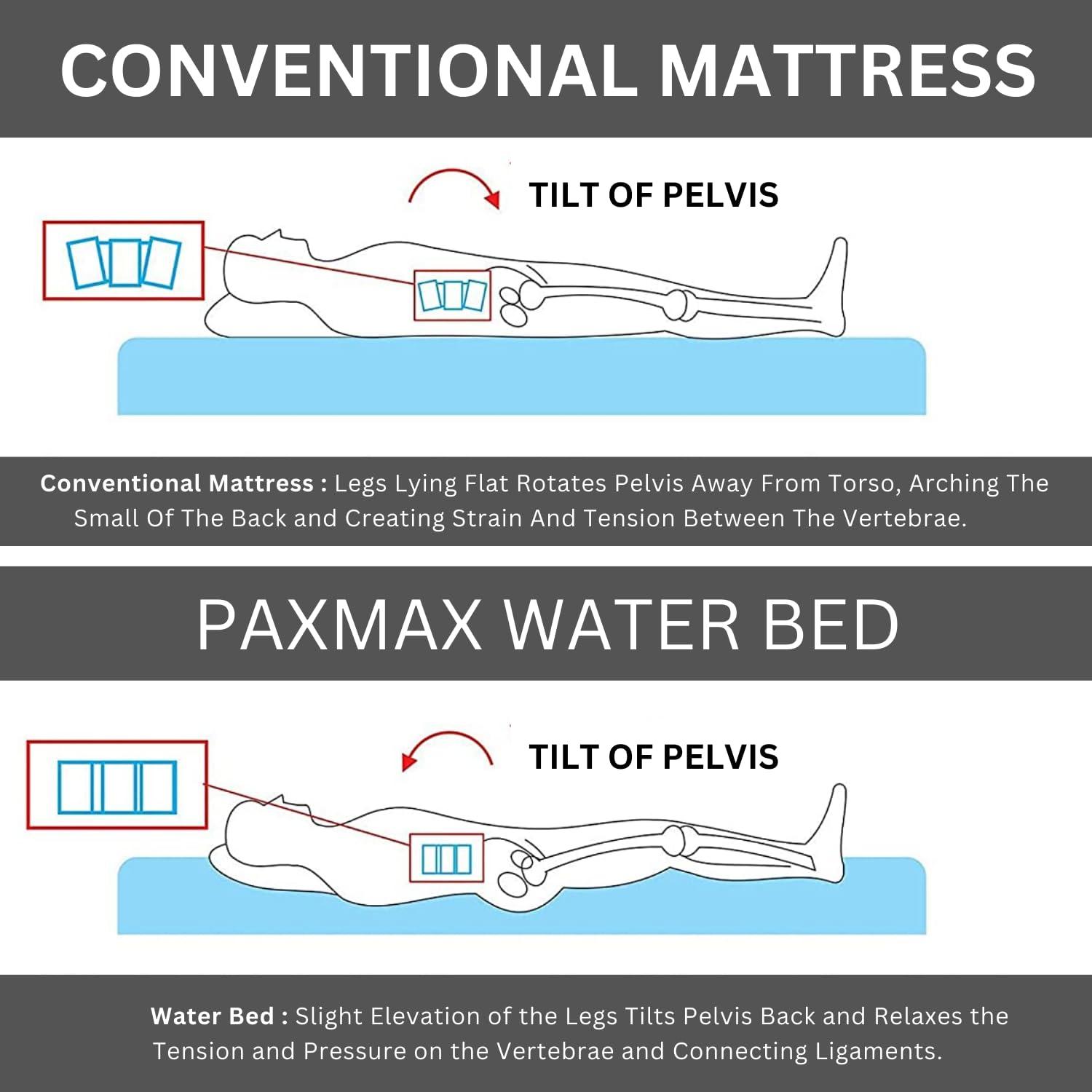 ARRPIT CARE ARRPIT CARE Polyvinyl Chloride Water Bed For Bed Sores Prevention For Bed Ridden Patient And In Long Term Hospitalization, Standard, Multicolored