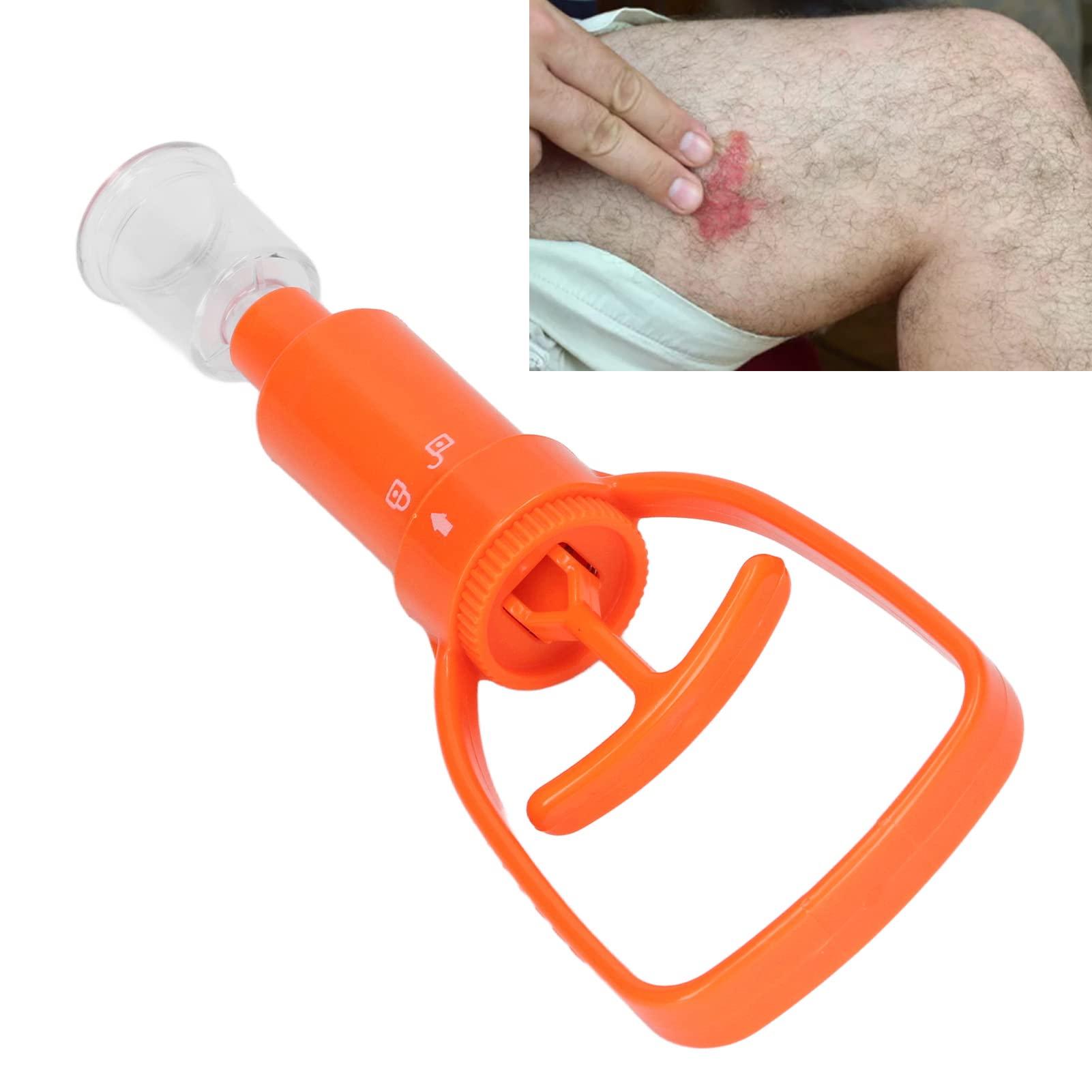 LIANAI Bites Relief & Itch Relief Suction Tool, Venom Extractor Suction Pump, Bee Sting Tool and Bites Sucker Kit, Reduce Itching & Swelling, Bite and Sting First Aid for Camping, Hiking