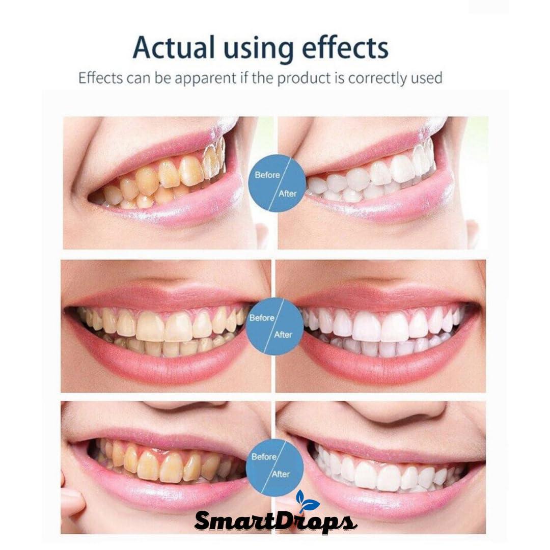 Smartdrops Whitening Foam Toothpaste for Sensitive Teeth, Snow Teeth foaming Whitening (60ml)