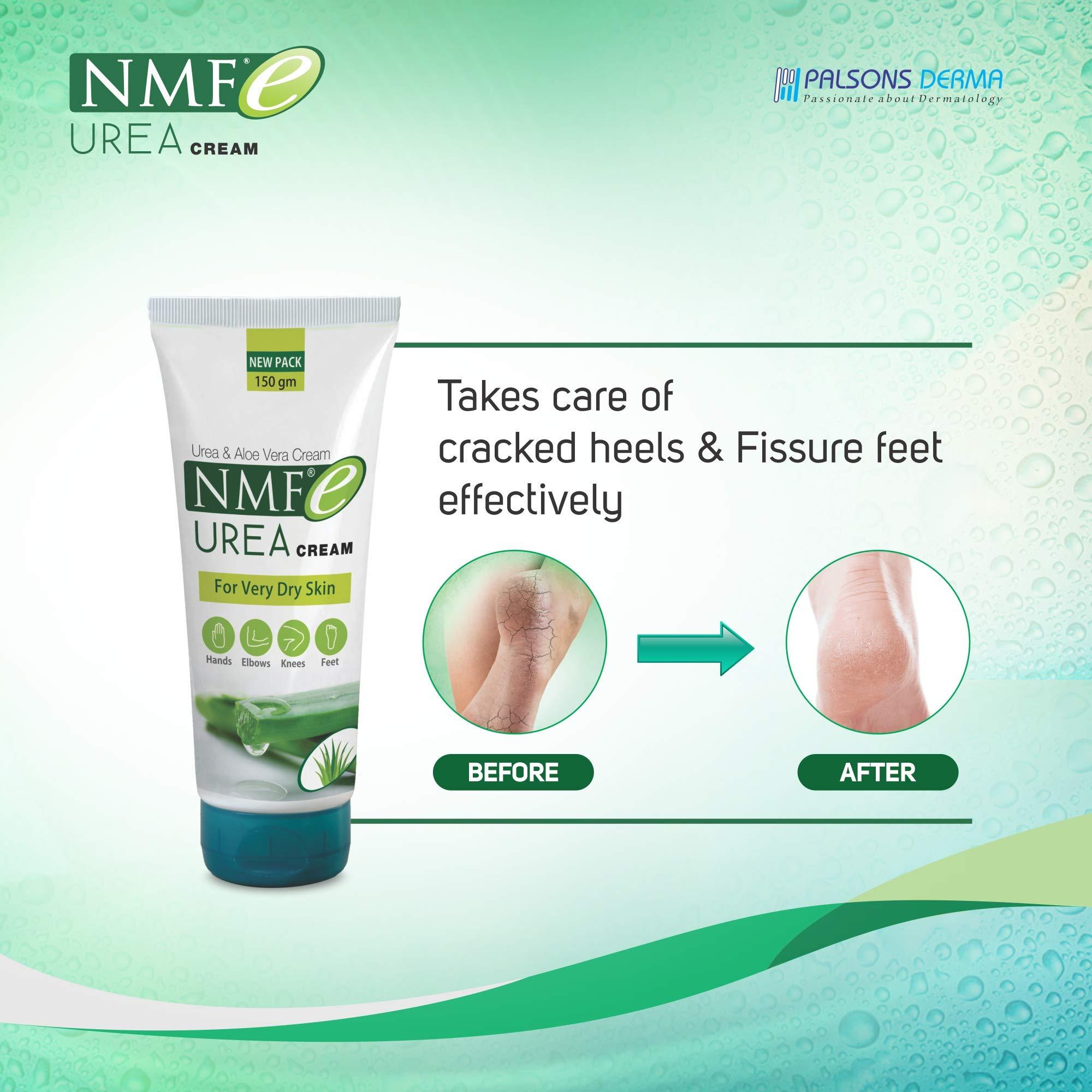 NMFe UREA CREAM NMFe Urea Cream 150 gm For Intense Moisturisation with Urea 7% & Aloe vera for thick and dry skin | Truly the Healing Moisturiser | For very dry skin | Takes care of cracked heels & Fissure feet effectively