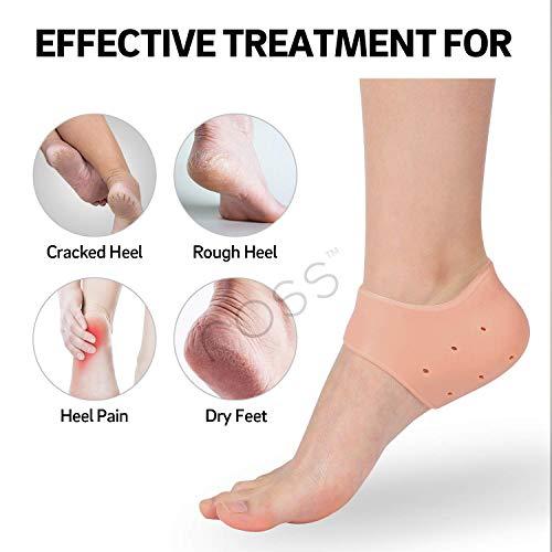 Cracked heel deals pain relief