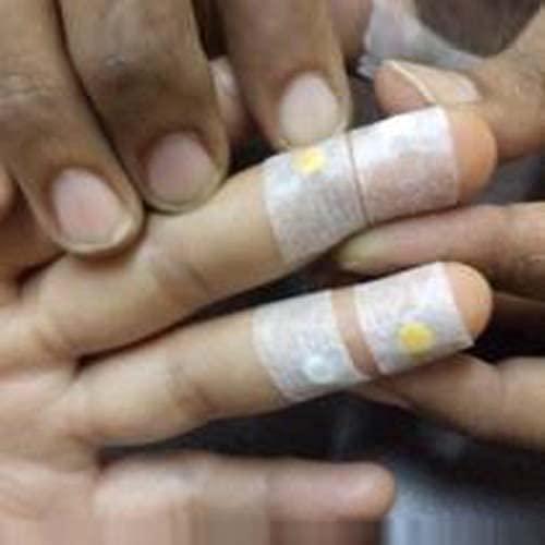 NETCLUB NETCLUB MS448 Acupressure Magnet Therapy Tools Combo sujok therapy Set Byol, Star, ENT Magnets & Sujok Finger Ring & Finger care massager & Paper Tape (Pack of 6)