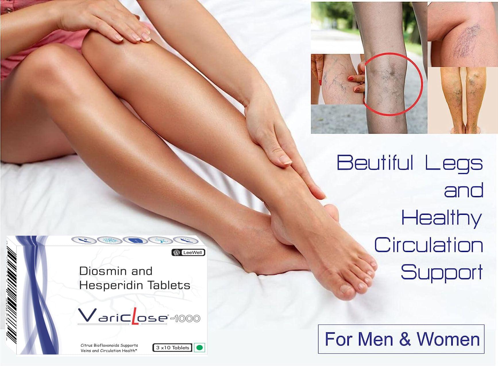 VARICLOSE Variclose -500 Advanced Support for Varicose Veins | Helps Strengthens Vein Wall & Improve Micro Circulation | Plant-based Nutrition for Restless Legs Health & Enlarged Vein discomfort | Citrus bioflavonoids Diosmin 450mg Hesperidin 50mg - 30 tablets