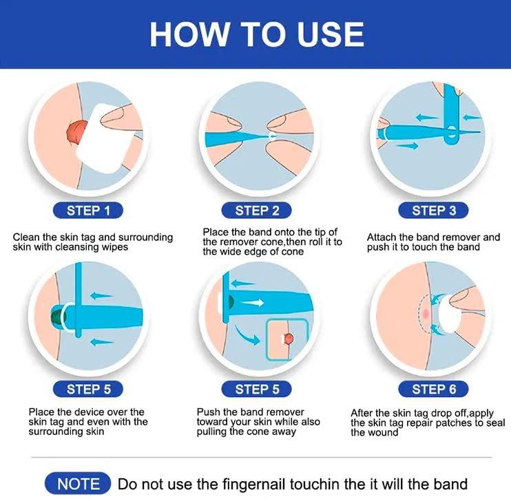 Generic Auto Skin Tag Remover Kit, Skin Tag Removal Patch, Skin Tag Remover Kit 2 in 1 Skin Tag Removal