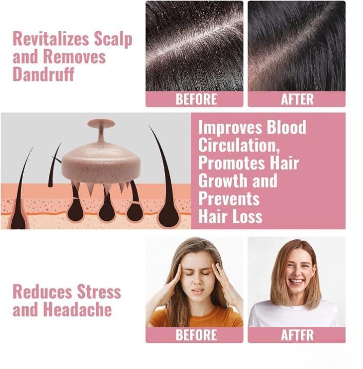 MR.SHOPPERS Mr.Shoppers Scalp Massager Shampoo Brush,Eco-Friendly Wheat Straw Body With Soft Silicon Bristles,Hair Scalp Scrubber,Scalp Exfoliator Dandruff Removal,Prevents Hair Loss For Men,Women (Pink Dotted)