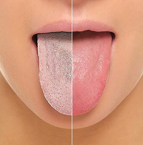 NJ NJ Stainless Steel Durable Tongue cleaner, Surgical Steel 304 grade material, FDA and SGS certified tongue cleaner: 3 Pcs