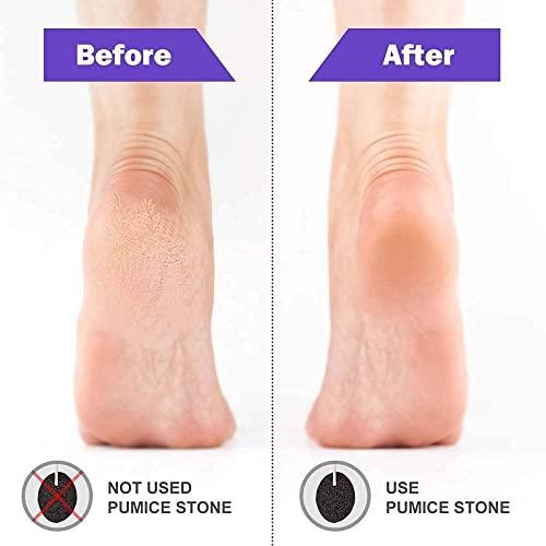 Red Square Pumice Stone 2 Pcs, Natural Lave Pumice Stone for Feet/Hand, Small Callus Remover/Foot Scrubber Stone for Men/Women - Multicolor (heart)