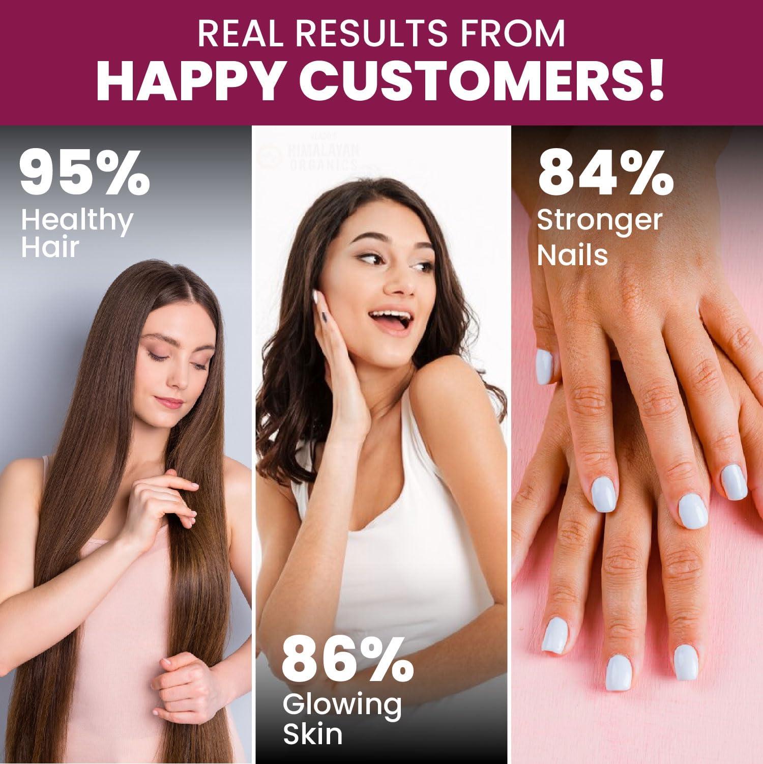 HIMALAYAN ORGANICS Himalayan Organics Biotin - Hair & Skin Gummies For Men and Women - 60 Gummies