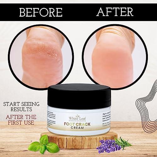 White Leaf White Leaf Foot Cream for Cracked Heels & Dry Feet, Foot Care Cream With Organic & Olive Oil, Moisturizing Healthy Feet for Men & Women - 50 gm