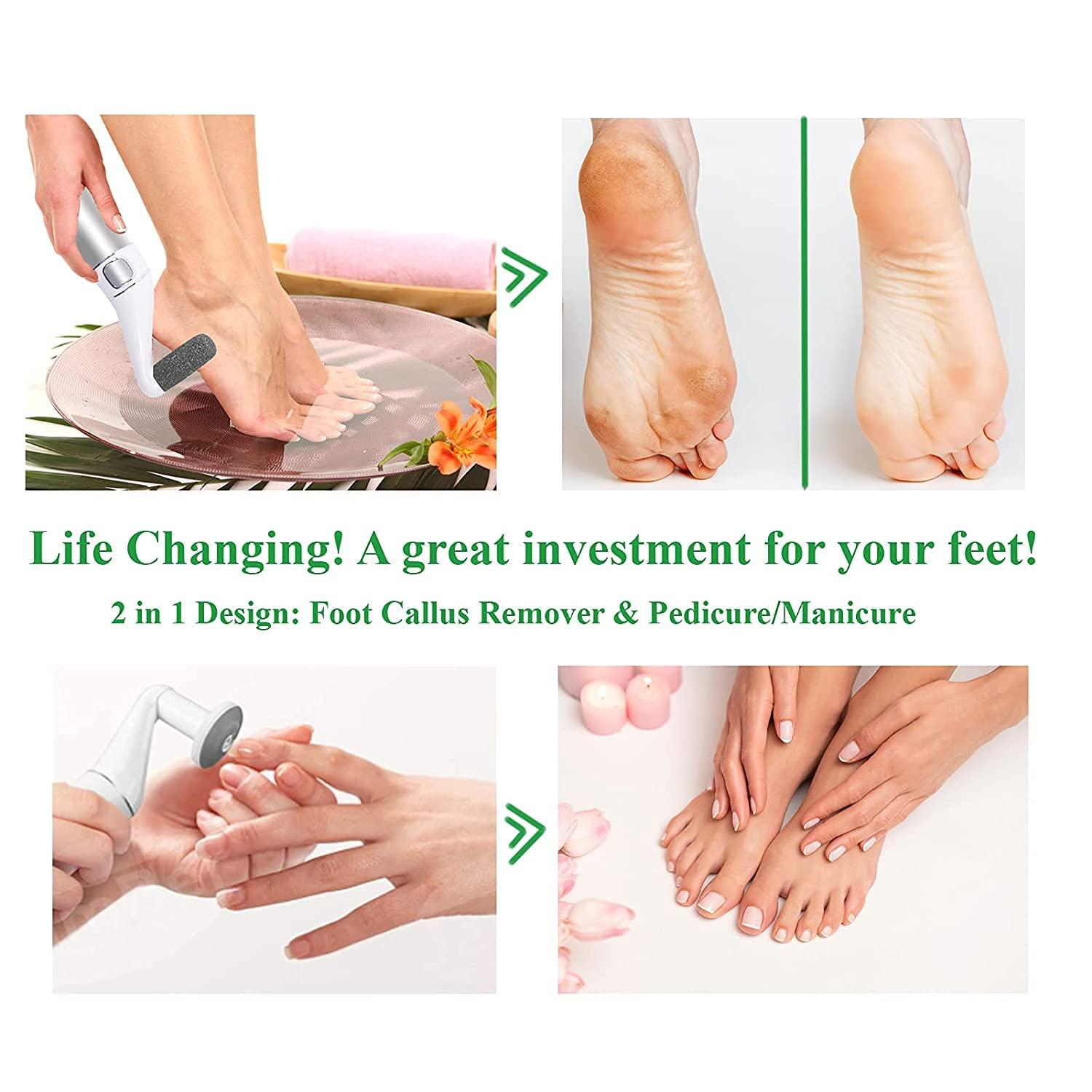 Ghime Ghime Pedicure Kit and Foot Scraper Electric Callus Remover with Blackhead Remover Detector Instrument Rechargeable With 6 Nozzles - Multicolor