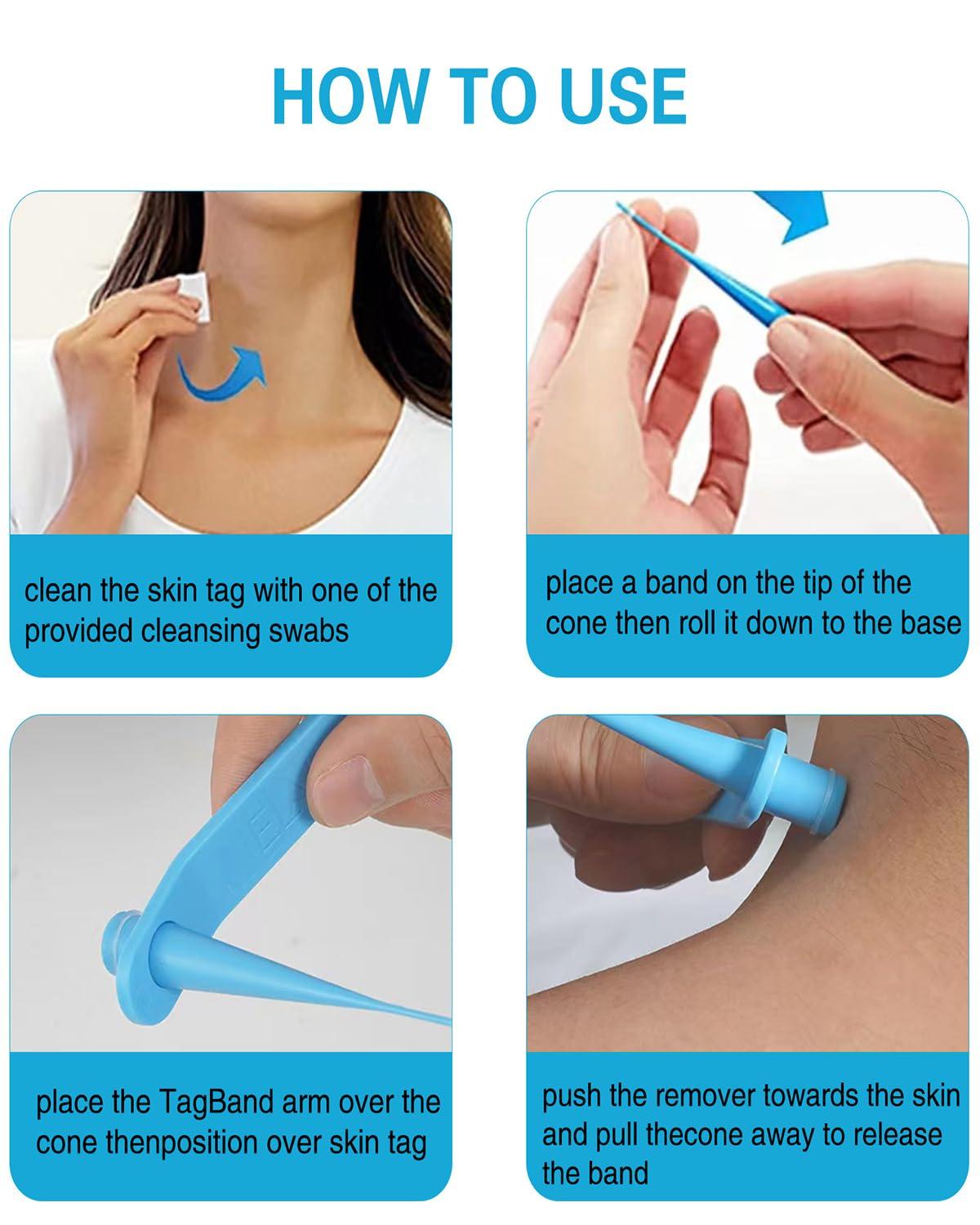 NHCDFA Skin Tag Remover Cream, Best Skin Tag Removal, Skin Tag Remover Kit, 3 in 1 Skin Tag Removal with Auto Skin Tag Remover, Face Care Mole Wart Tool, Skin Tag Remover Set