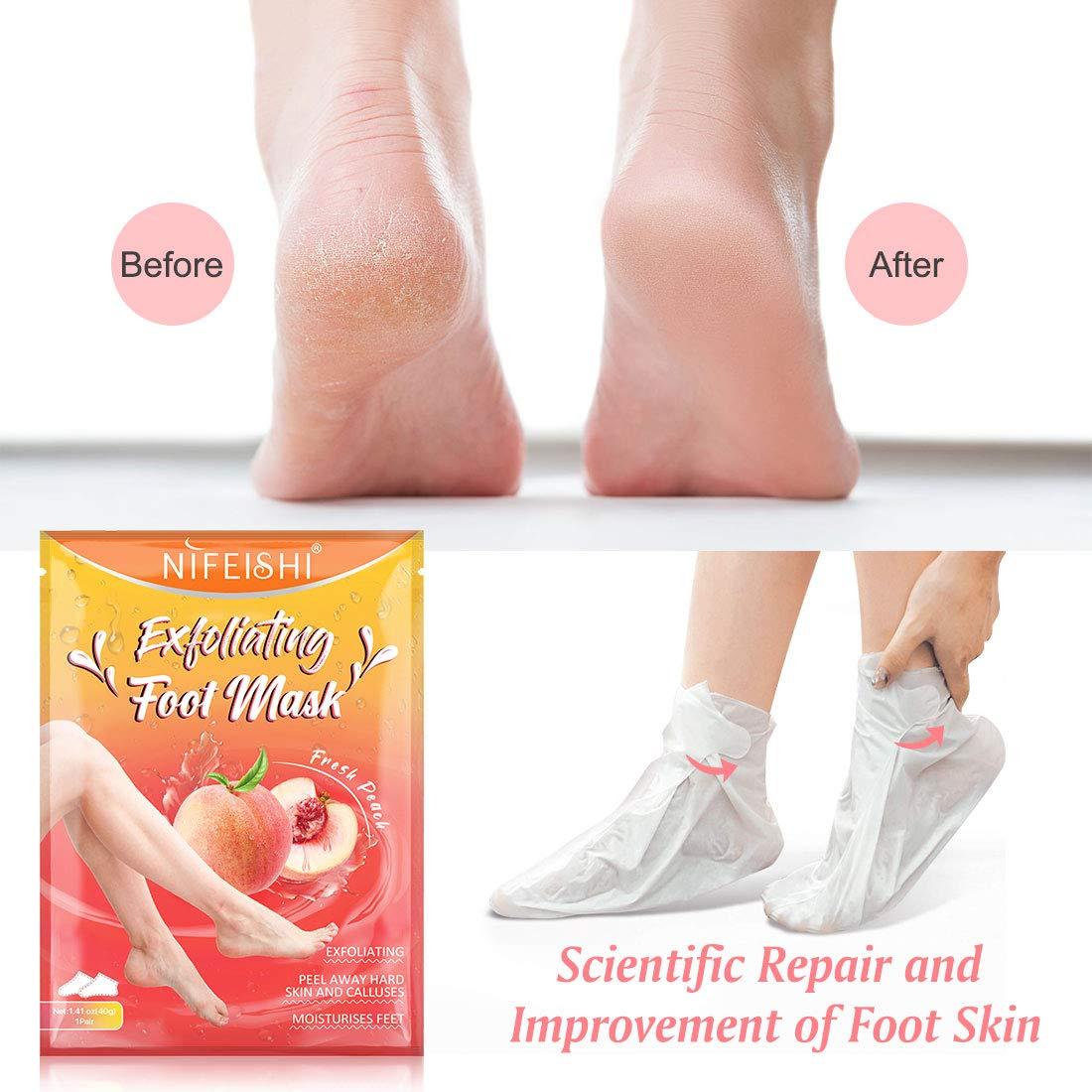 NIFEISHI Foot Peel Mask - 5 Pack of Peach Foot Mask - Removes Calluses,Dead and Dry Skin - Repairs Rough Heels, Foot Peeling Mask for Women and Men
