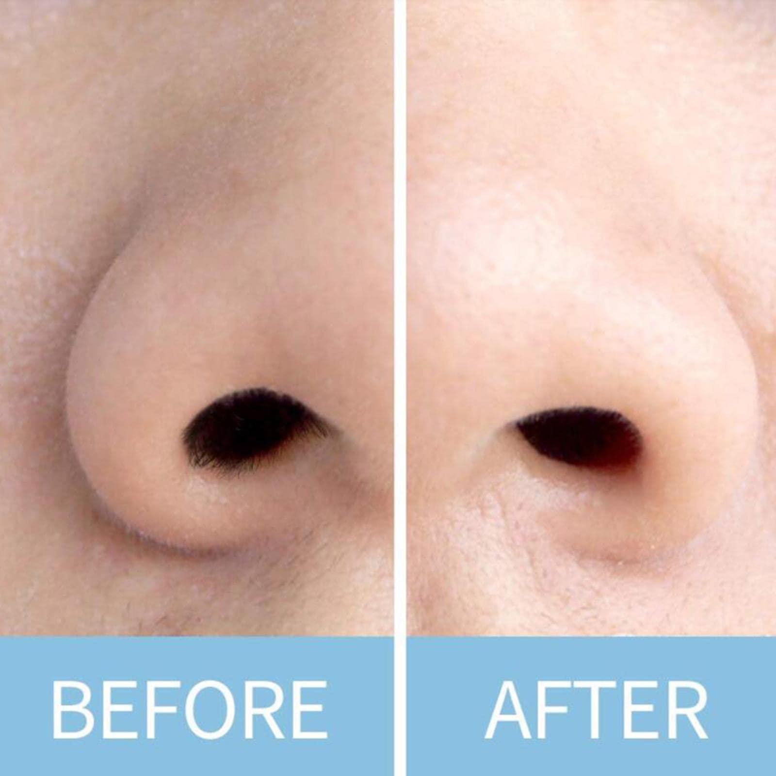 Generic Losa Nose Hair Removal Sticks Nose Wax Applicator for Nostril Nasal Cleaning 100pcs