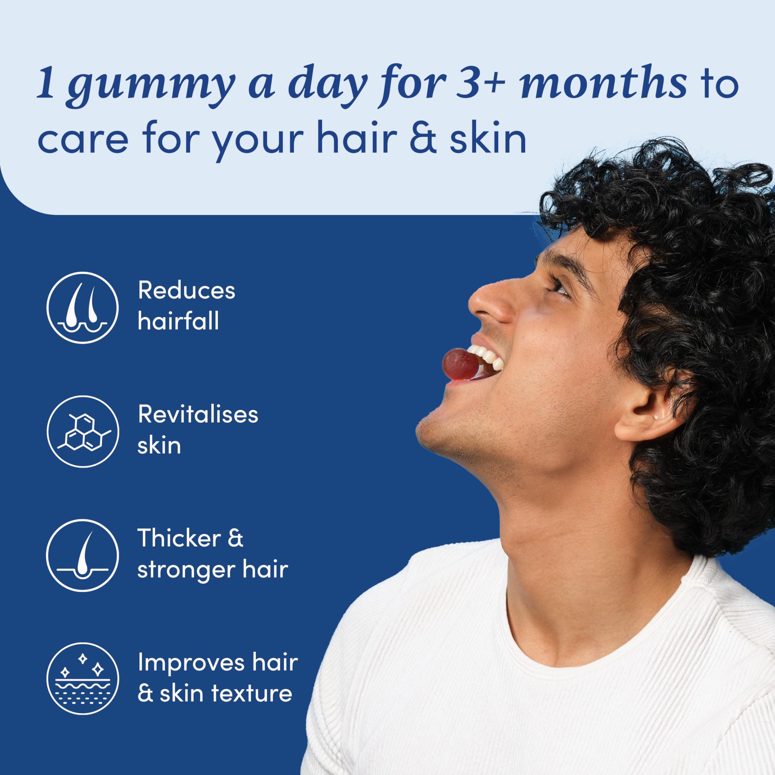 Man Matters Man Matters Biotin Hair Gummies (30N) | No Added Sugar | With Biotin, DHT Blockers, Vitamin A, C, E, Zinc & Fibre | For Healthy & Strong Hair | Strawberry Flavour | 100% Vegan & Gut Friendly