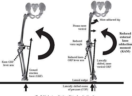 SHIVSAKTI 1 Pair (1 for right leg + 1 for Left leg) Lateral Wedge for genu varum and medial knee osteoarthritis correction (large)
