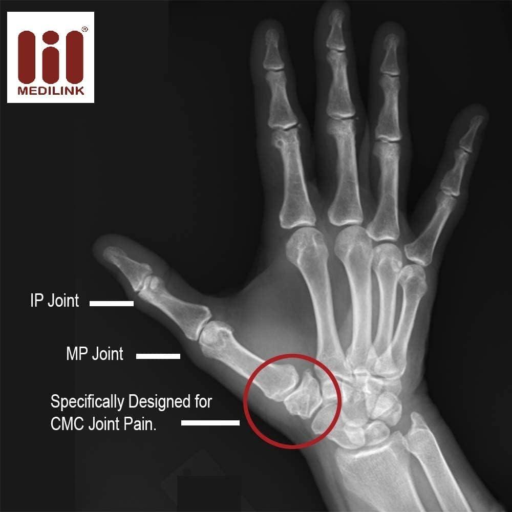 Medilink Medilink Thumb Spica Splint- Thumb Stabilizer - Thumb Brace for Tissue Injuries