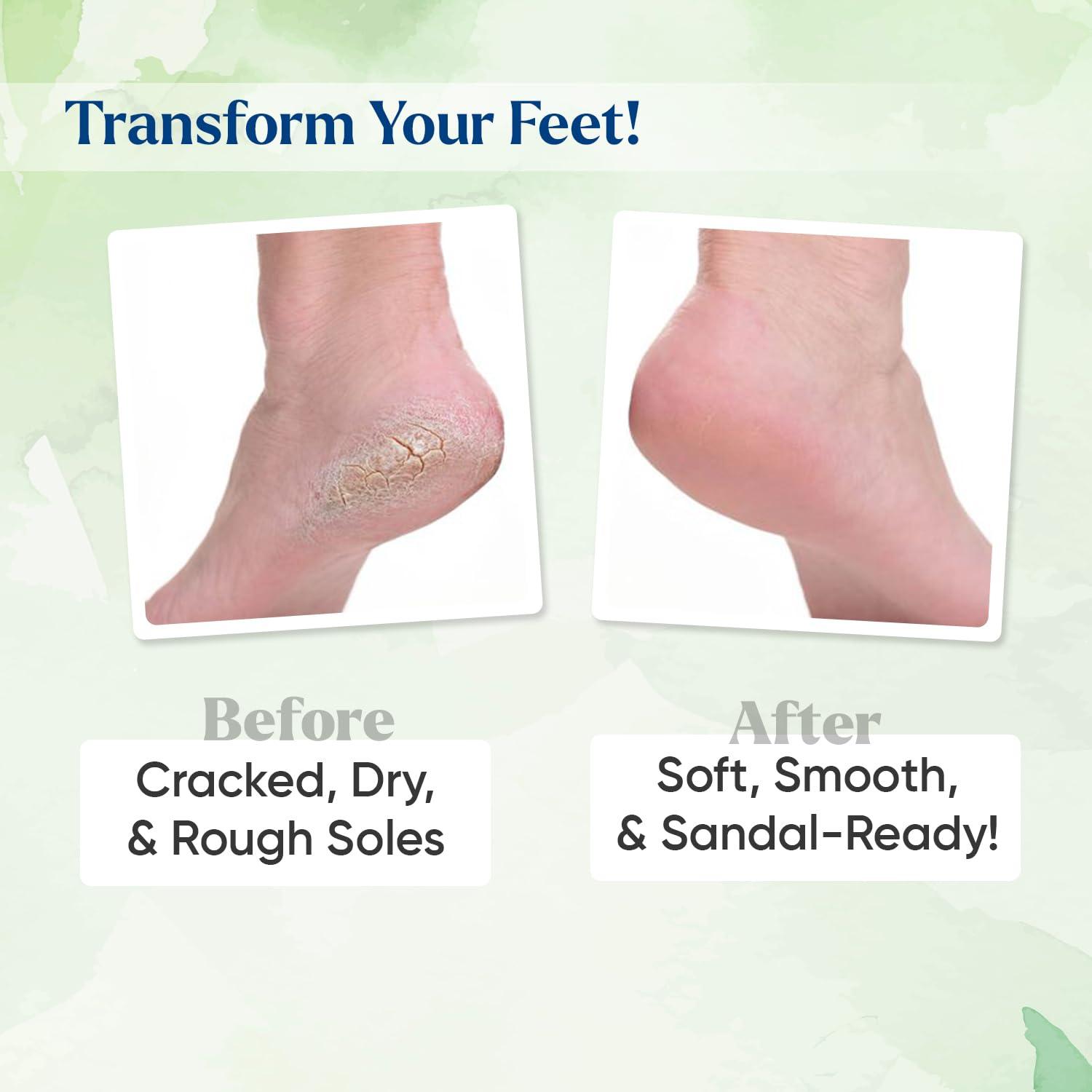 SOFTSOLES Soft Soles | Foot Cream | Crack Heal Repair Cream | Nourishes & Rehydrates | Softens Hard Skin | Heal Care Cream Pack of 4 (30g each)