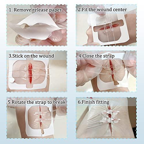 Mediss Mediss Emergency Wound Closures Band-Aid Adhesive Bandages, Zip Stitch Stickers For Camping, Survival & Household Gear, 2 Pcs/Box