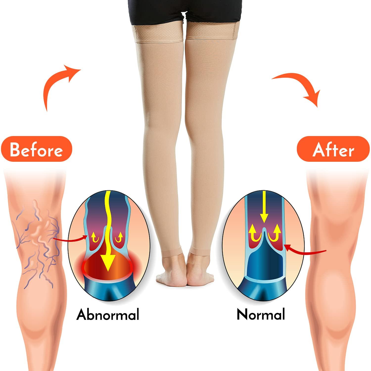 DOGOU DOGOU 1 Pair Thigh High Socks Men Women 20-30mmHg Stockings Sleeves for Varicose Vein Swelling