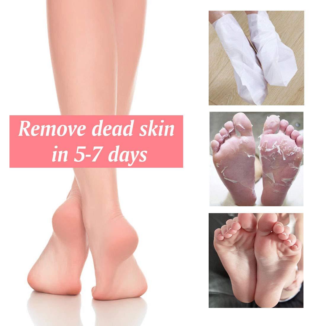 NIFEISHI Foot Peel Mask - 5 Pack of Peach Foot Mask - Removes Calluses,Dead and Dry Skin - Repairs Rough Heels, Foot Peeling Mask for Women and Men