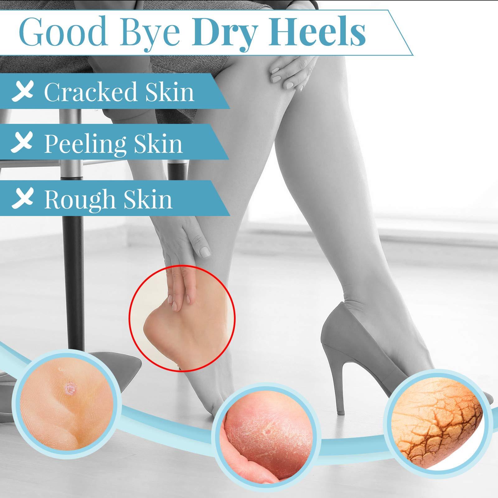 Geyoga Geyoga 2 Pairs Of Open-Toe Moisturising Gel Heel Socks, Spa Sock For Men Or Women Foot Care, Cracked Heels, Dry Feet, Foot Calluses, Dead Skin, Black, Grey
