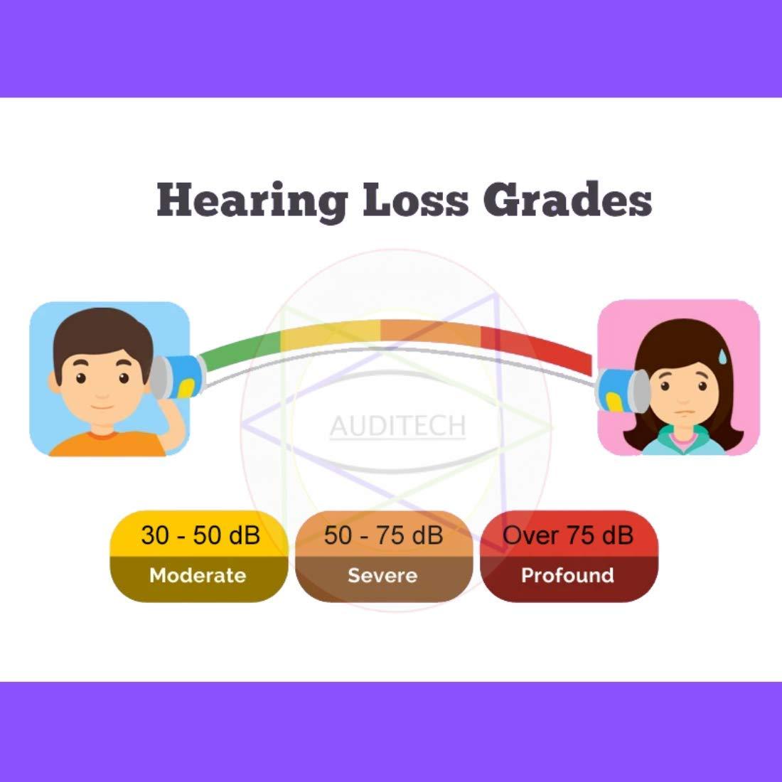 AUDITECH AUDITECH Diamond Ultra Sound Enhancement Amplifier Behind The Ear Hearing Aid Beige (With 12 Batteries)