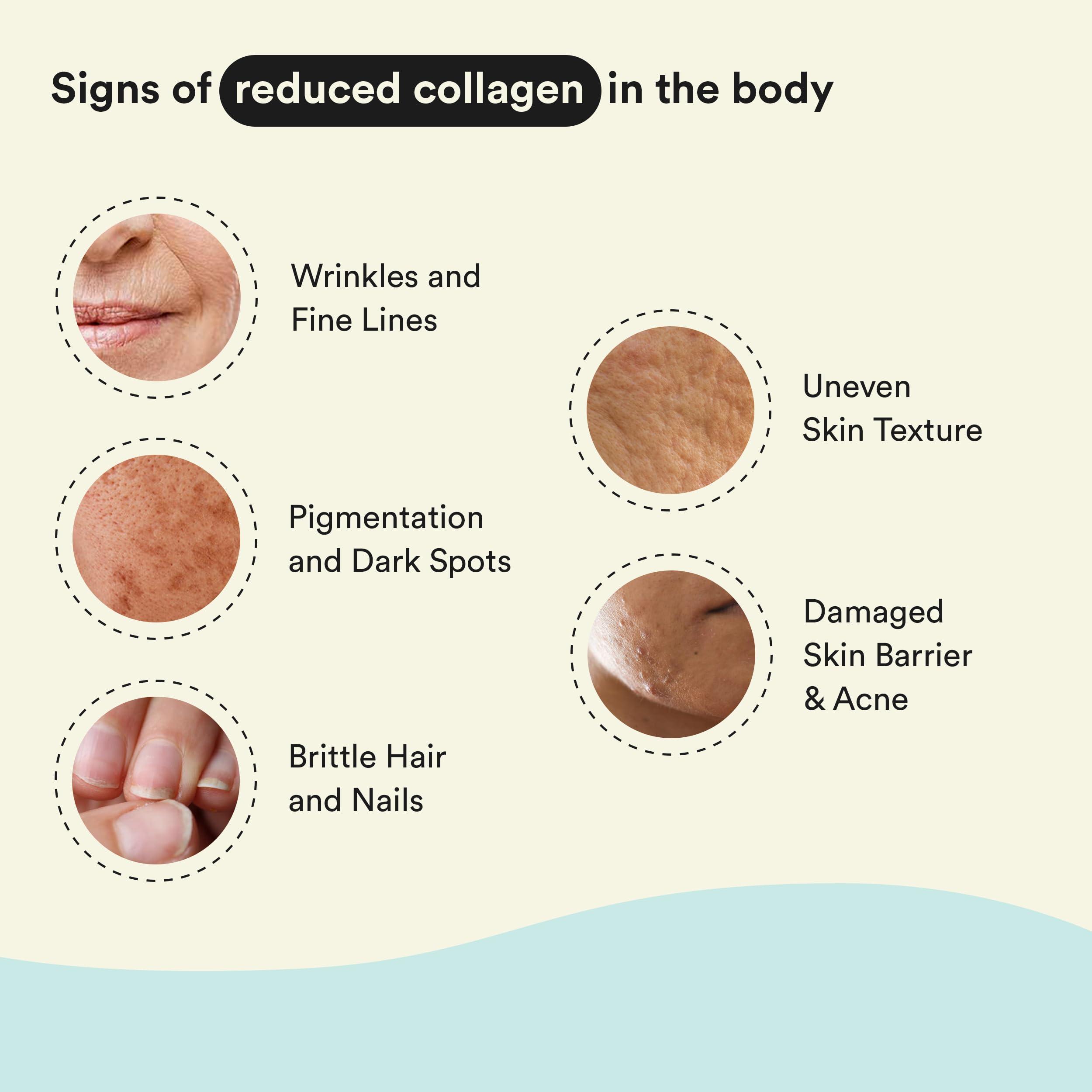 Bloom by Boldcare Bloom Collagen Powder + Antioxidants Easy Pour Sticks | 30 Easy Pour Sticks (Pack of 1) | Collagen Supplements for Women | For Skin Elasticity and Hyperpigmentation | Orange Flavour