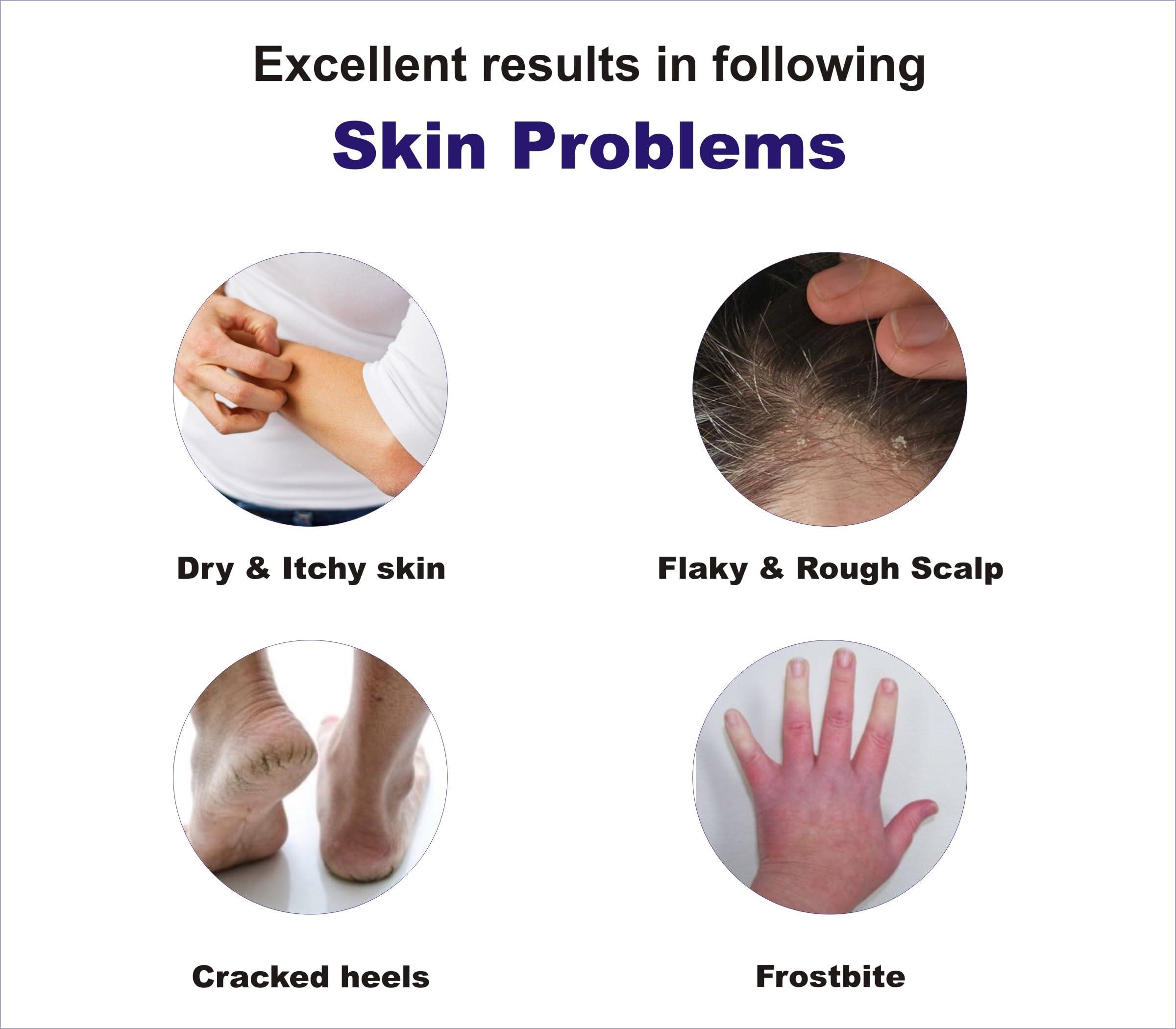 OSTA-D3 OSTA-D3 Family Massage Oil 100 ml