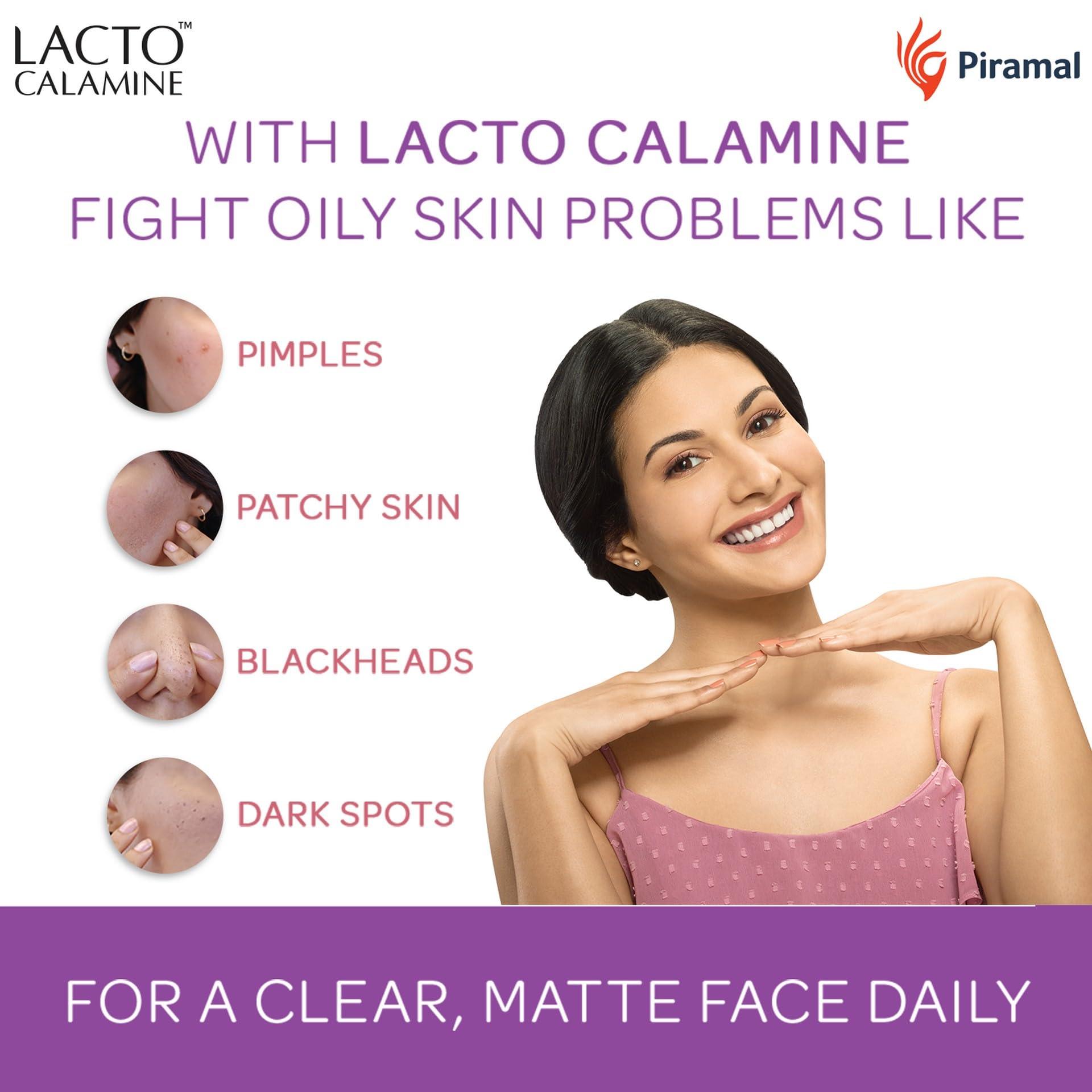 Lacto Calamine Lacto Calamine Face Lotion for Oil Balance - Oily Skin - 30 ml