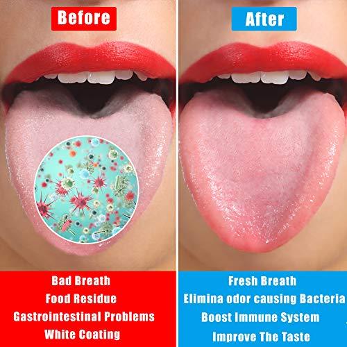 UUZIYOU Stainless Steel Tongue Scraper Cleaner, 2 Pack Fresh Breath Tongue Cleaner for Adults, Kids, Men and Women, Surgical Grade Metal Scraper for Healty Oral Care, Bad Breath Cure (with 2 Travel Cases)