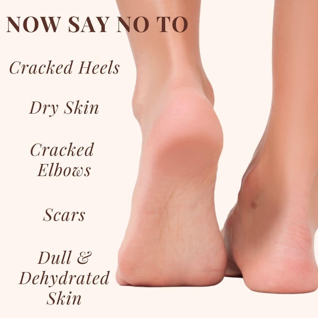 ESSENTIA EXTRACTS ESSENTIA EXTRACTS Crack Repair Oil - For Cracked Heels and Elbows, 100ml | A blend of Cold-Pressed Oils | 100% Natural, Pure,Not tested on Animals (200ml(100ml+100ml))