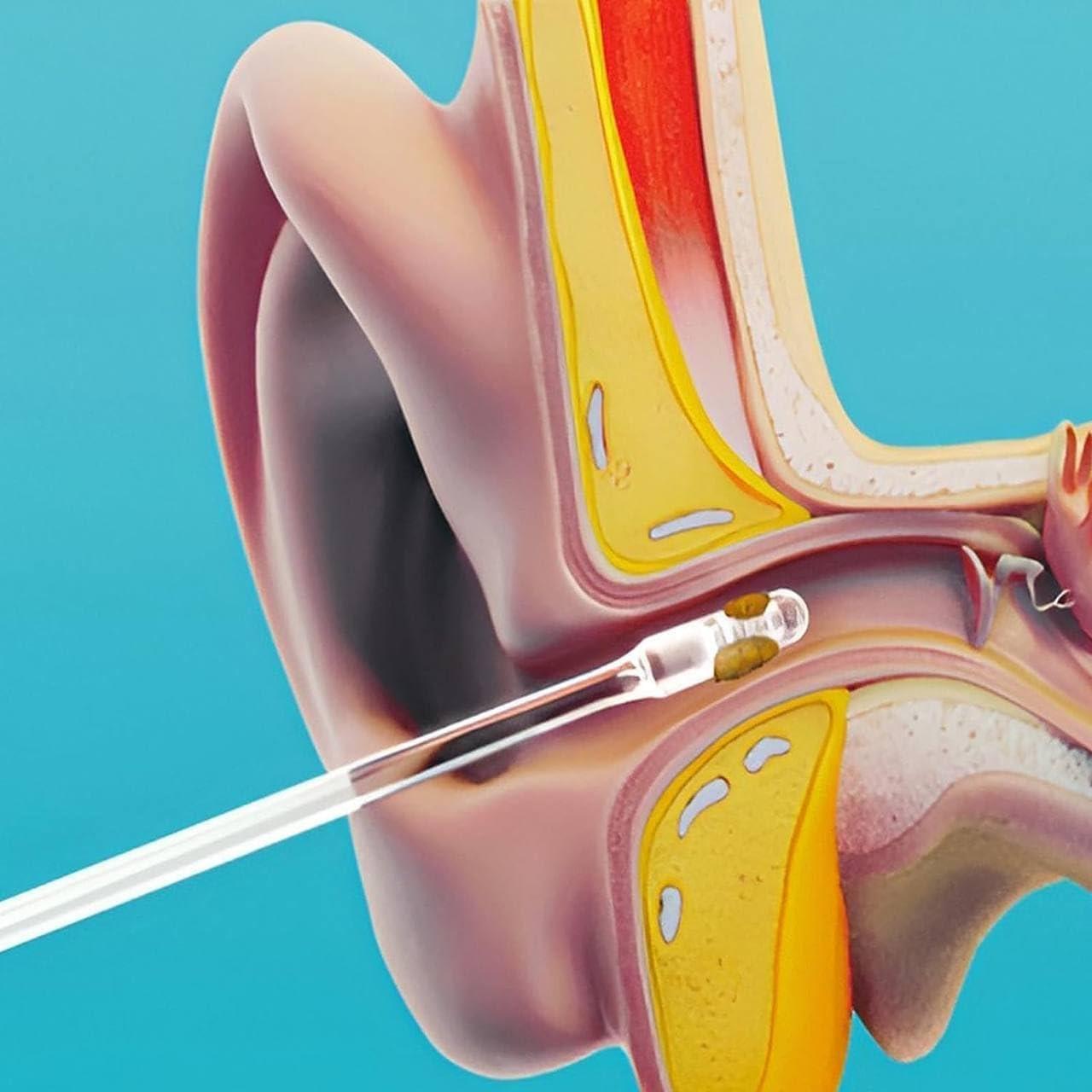 Cazuela Cazuela Ear wax Cleaner Stick - Ear Swabs Pick Reusable Ear Cleaner Soft Silicone Ear Pick For Ear Wax Removal Tool, Ear Pick For Ear Cleaning, Ear Buds Catcher For Older Adult Kid (24Pcs)