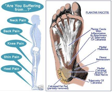 Bulk Buys Kole Imports Memory Foam Heel Cushion Reduces Heel Shock and Pressure
