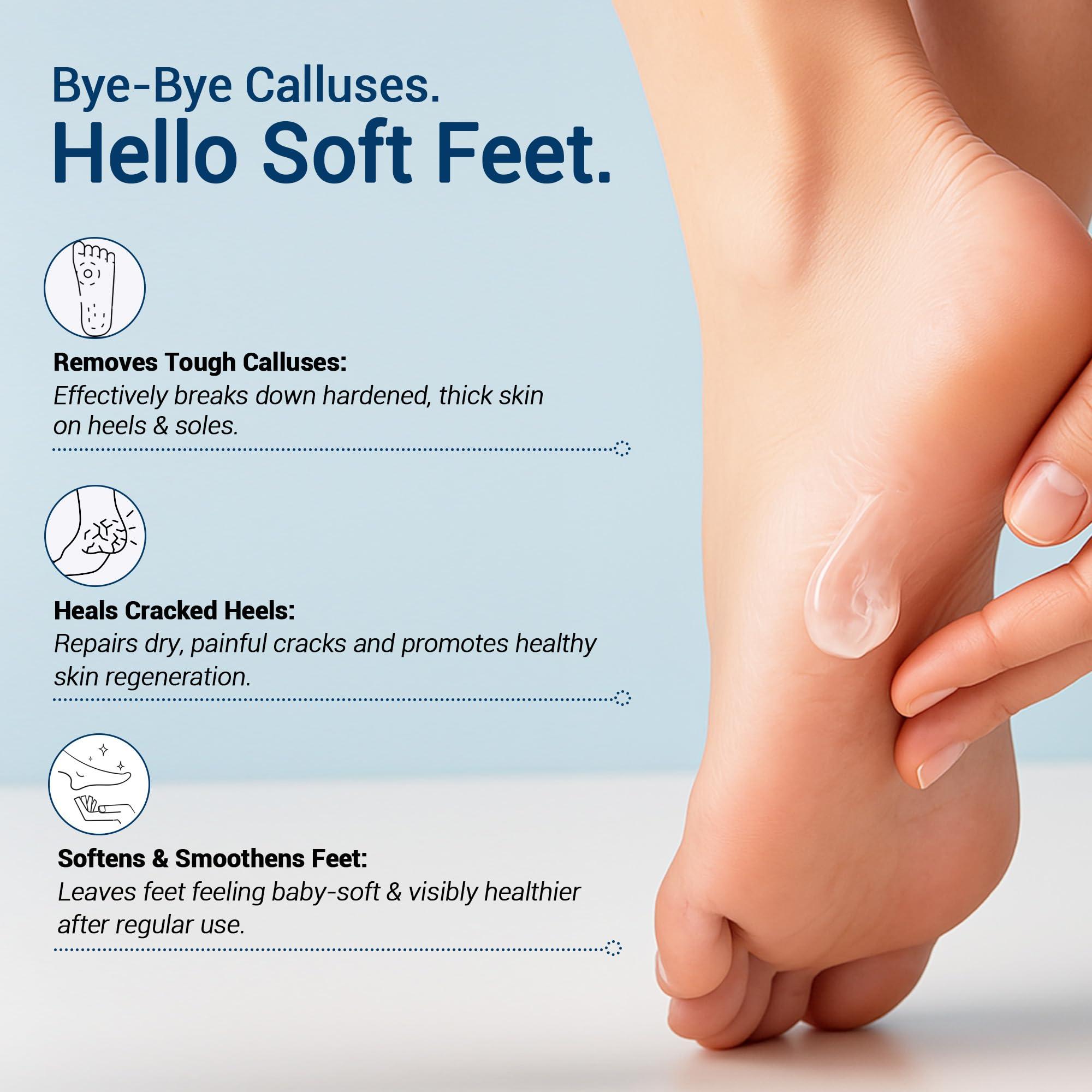 Dr Foot Dr Foot | Callus Remover for Feet | Callus Remover Gel | Feet Dead Skin Remover | Foot Cream for Cracked Heels | Foot Cleaner for Dead Skin | With Urea, Coconut Oil & Aloe Vera | For Men & Women