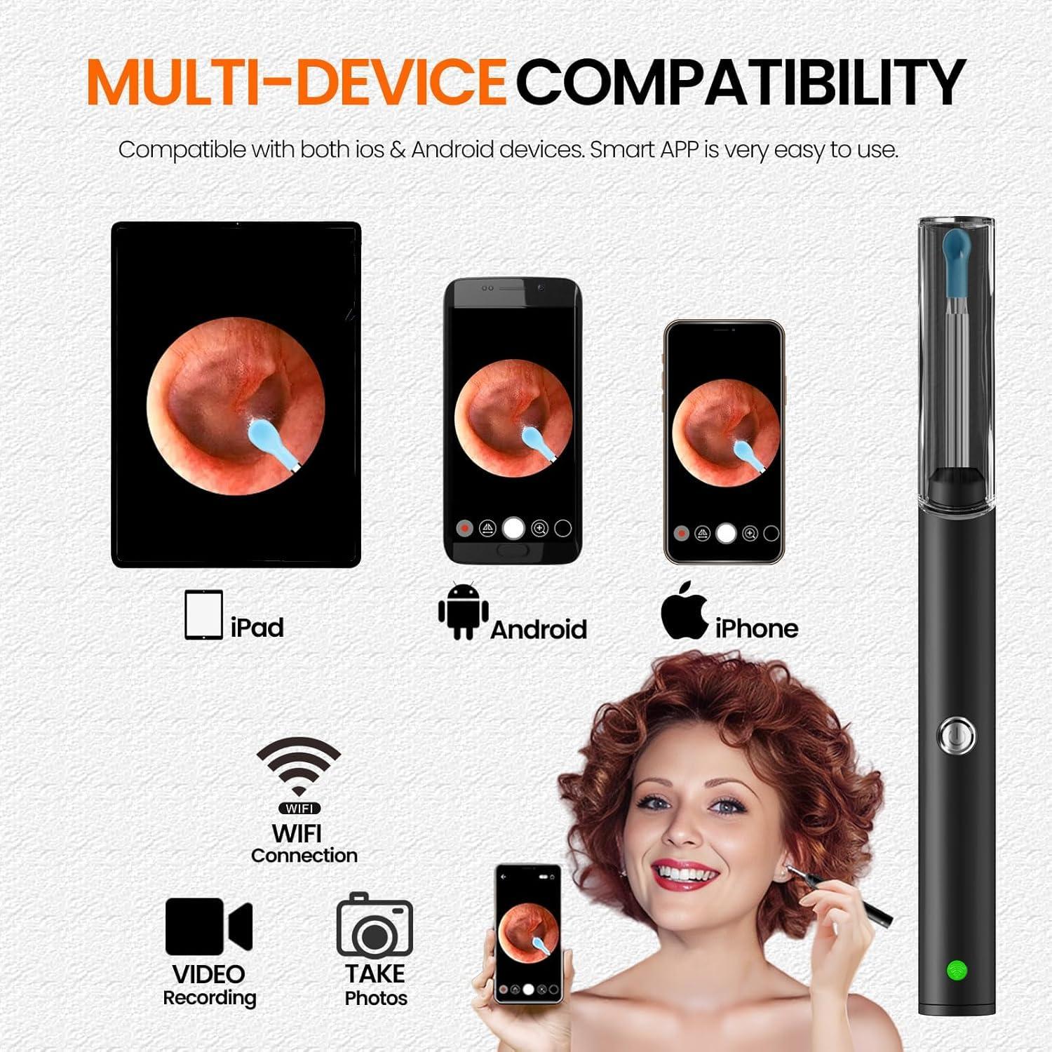 NOVUSOL NOVUSOL Ear Wax Removal Tool Kit, 9 Pcs Ear Otoscope Camera Wireless 1296P HD 3.5mm Ear Wax Cleaner with 6 Led Light 350mAh Ear Camera for iOS & Android, Black 1 Year Warranty