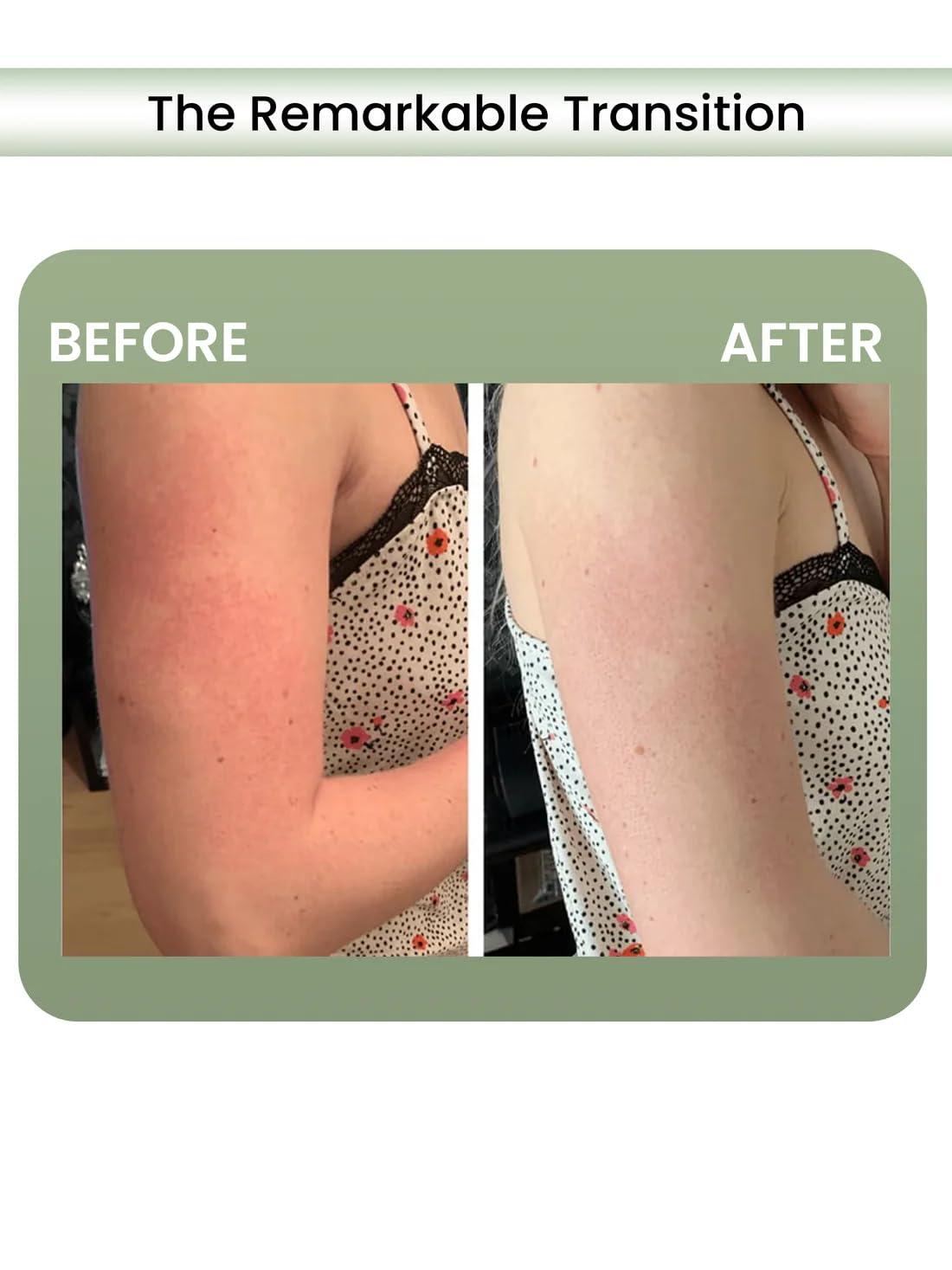 The Wellness Shop The Wellness Shop Post Wax Claming Gel | With Aloe-Vera and Vitamin E | For Soothes Irritation and Redness | Deeply Hydrates and Nourishing | Easy to Absorbs | Organic Ingredients | 50ML