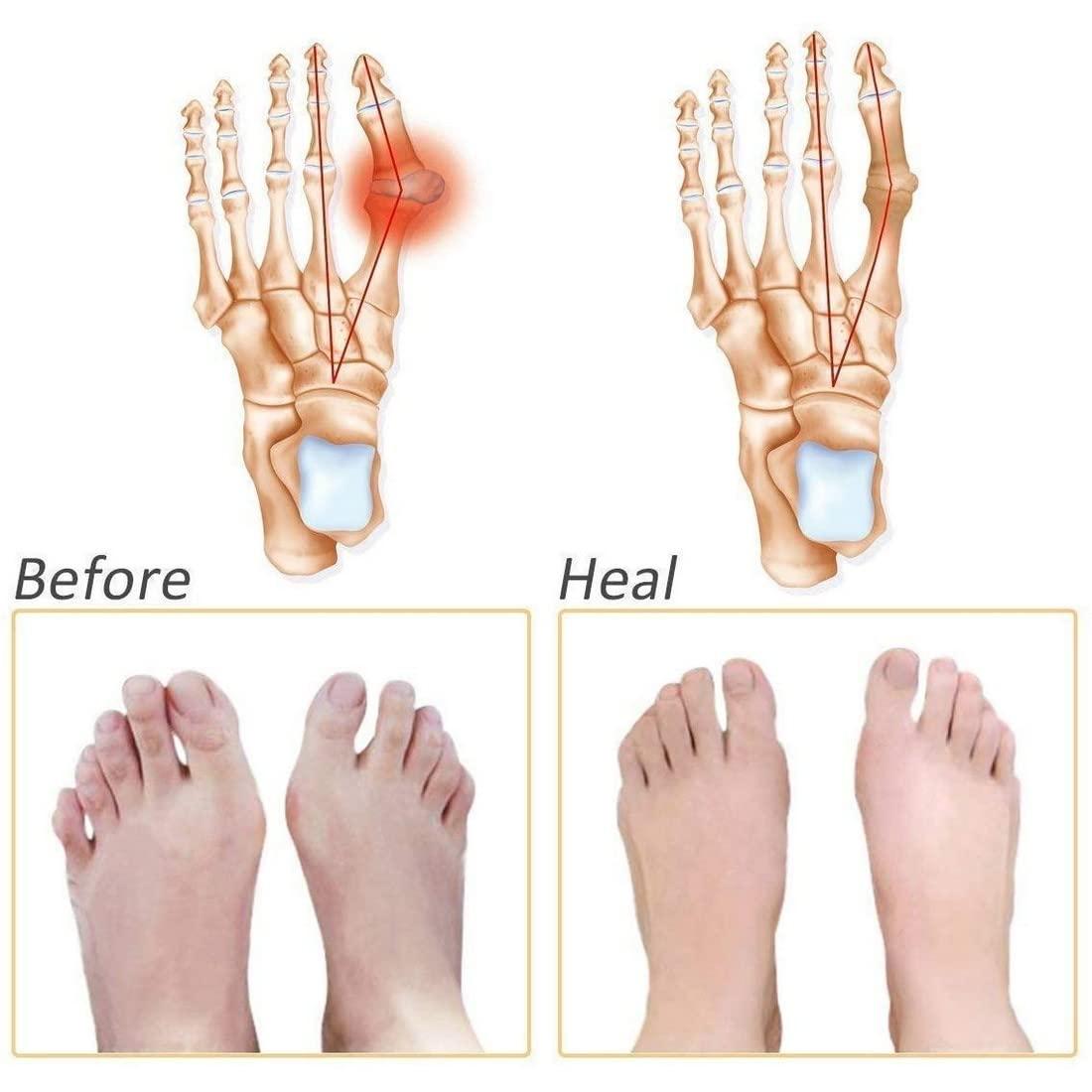 Das Palace Das Palace Silicone Gel Half Toe Sleeve Anti-Skid Forefoot Soft Pads For Pain Relief Heel Front Socks Silicone Heel Protector Foot Gel Socks For Repair Dry Cracked Skins (White)