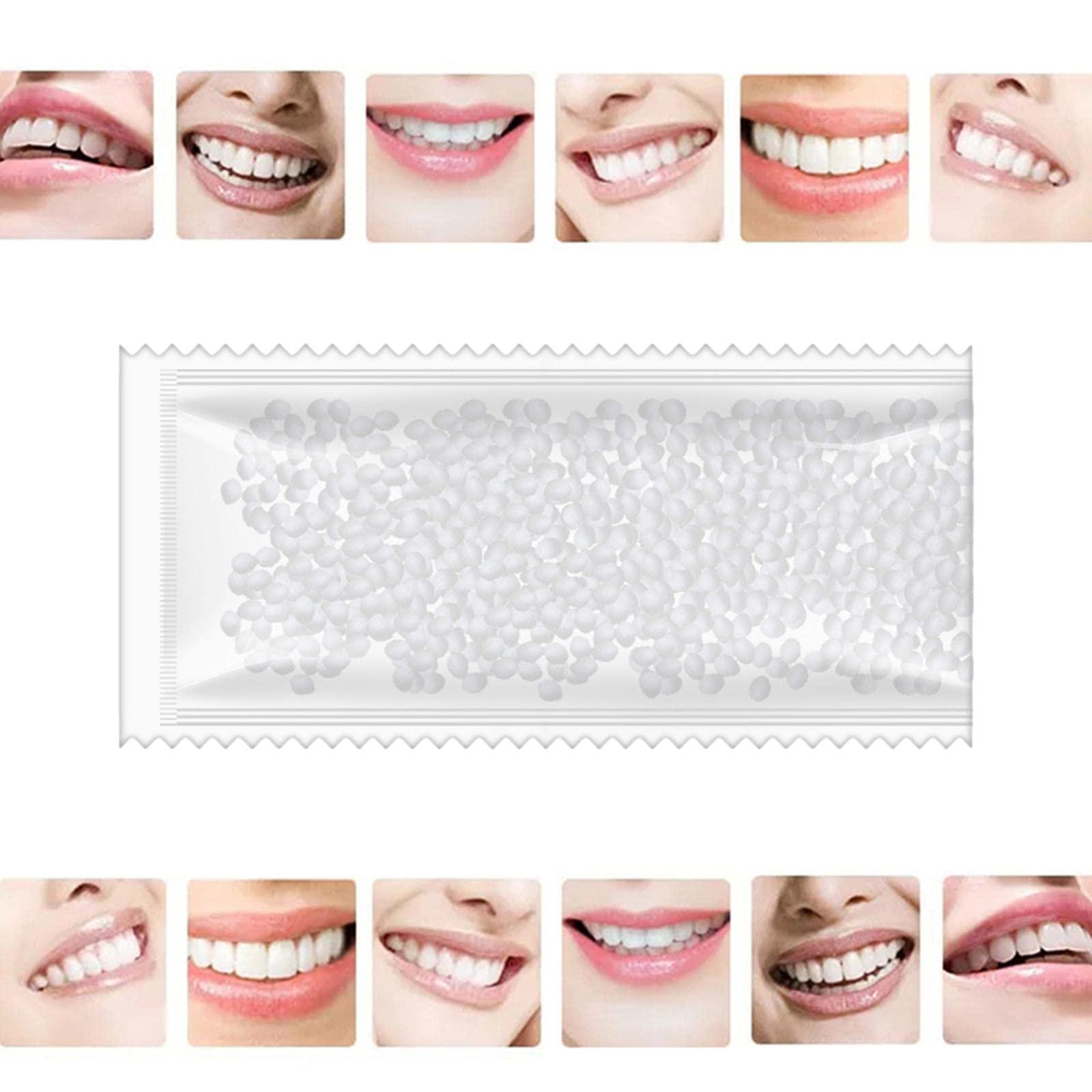 CALANDIS CALANDIS 1 Tooth Repair Kit DIY Tooth Filling Thermal Beads Temporary Teeth Repair Moldable 10G