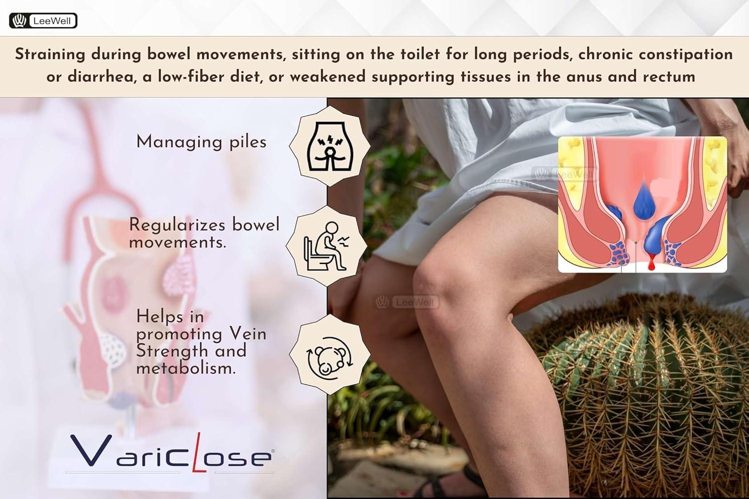 VARICLOSE Variclose Varicose Vein Support | Restless Legs Circulation Flow, Cramps, Twisted, Enlarged, Discolored Veins Aid | Diosmin, Hesperidin, Horse Chestnut extract (Aescin), Butcher\'s broom extract (Ruscogenins) - 30 Tablets (Leewell Pharma)